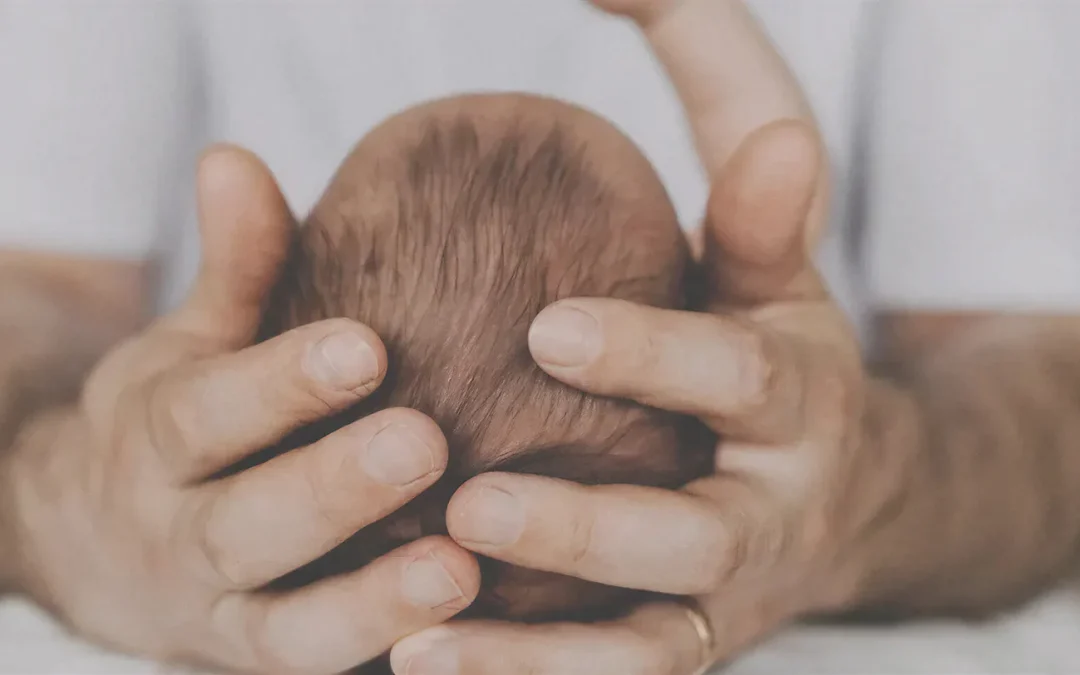 Skull deformities in babies