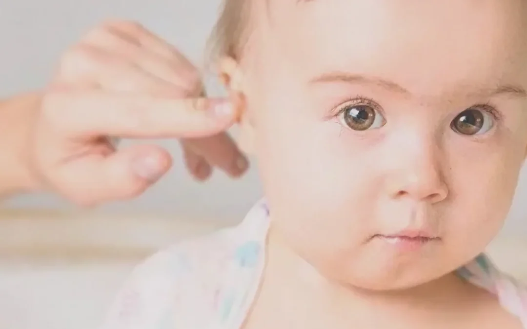 Protruding ears, the reasons