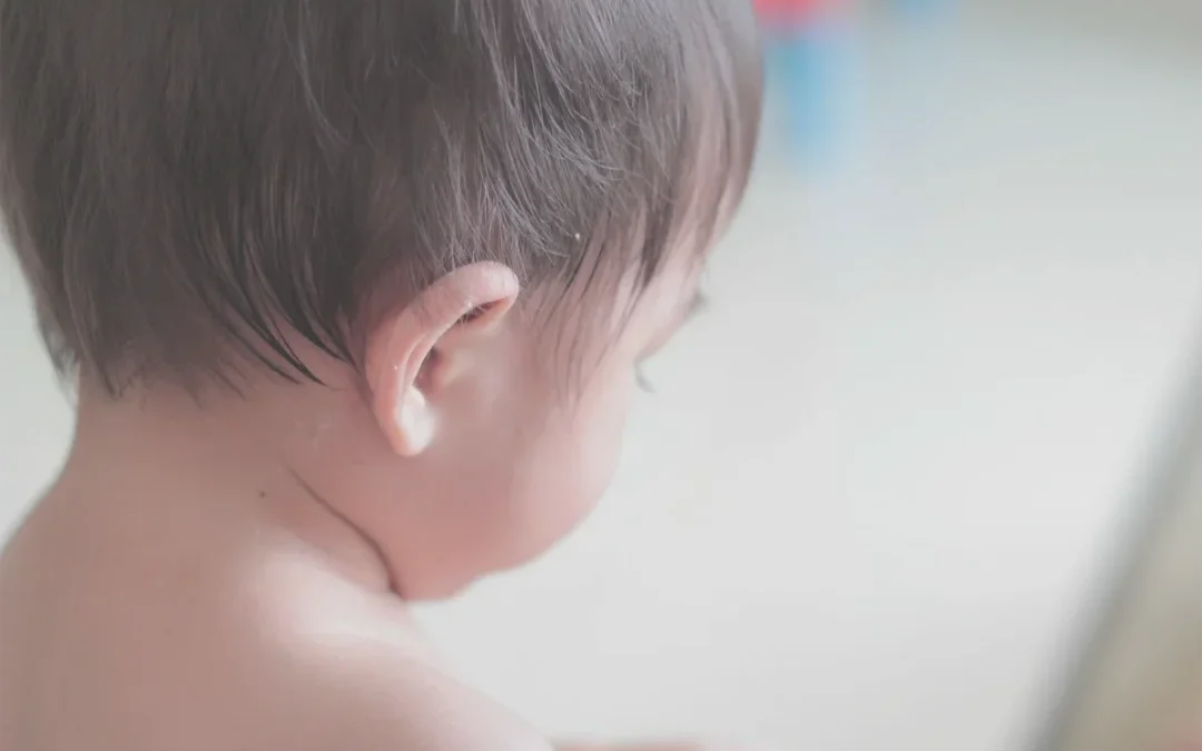 Orejas despegadas y otoplastia: una opción, no una obligación